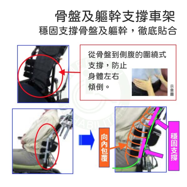 強生 8D多功能特製輪椅 脊椎側彎 圓背 機械式輪椅 輪椅 MH-CR3D-400-F-1 JUST 4U 符合輔助項目
